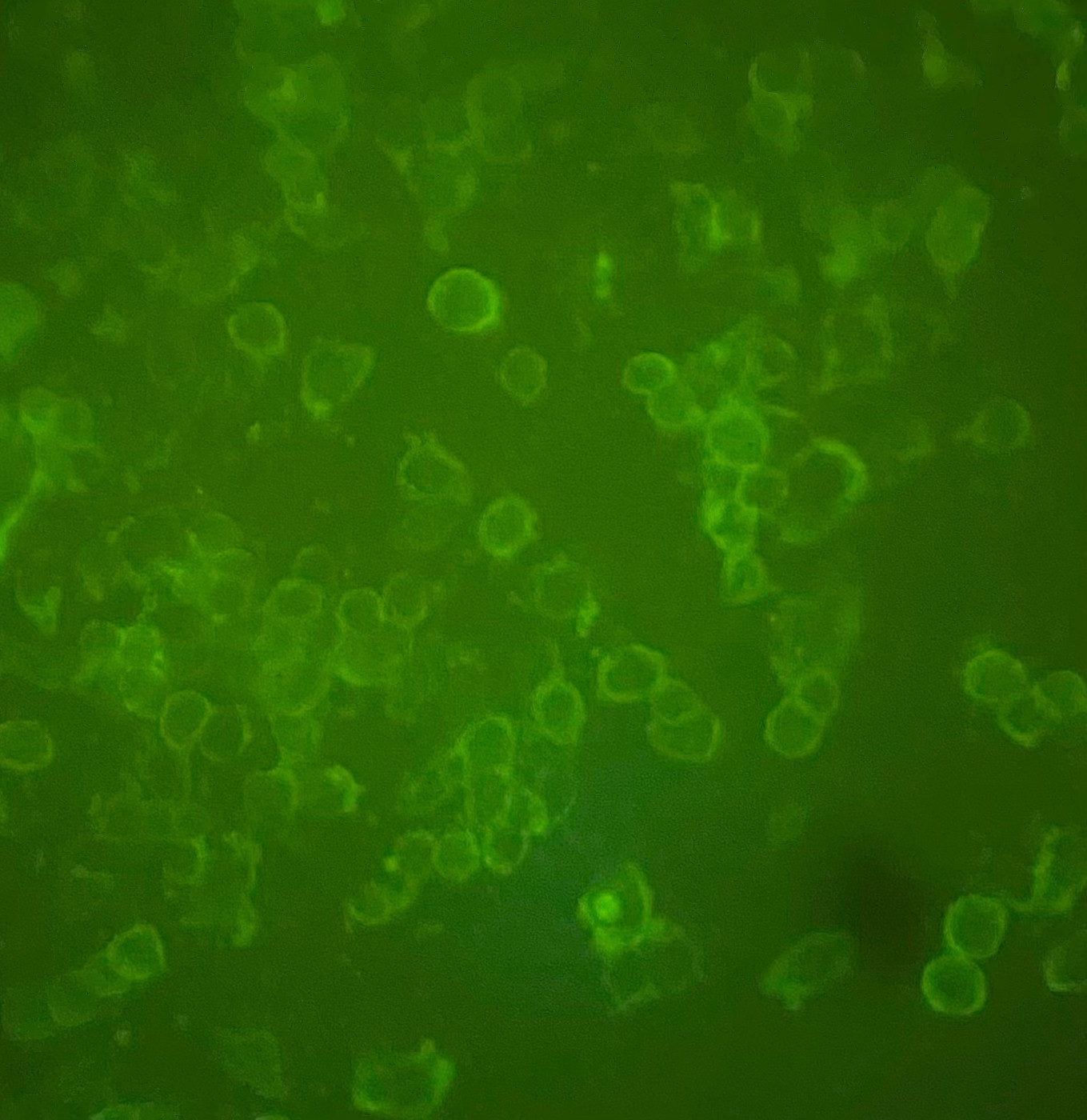 Aptamer binding, in vitro